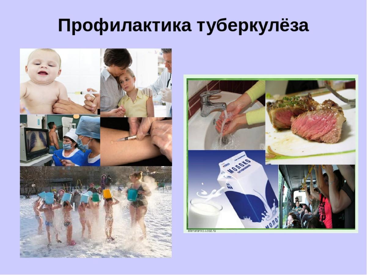 Профилактика туберкулёза. Профилактика туберкулёза.