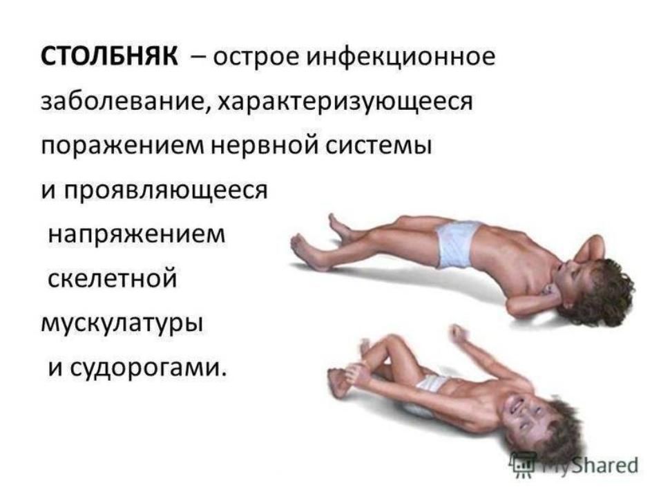 О профилактике столбняка.