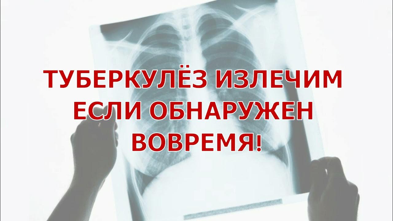 ТУБЕРКУЛЕЗ ИЗЛЕЧИМ!