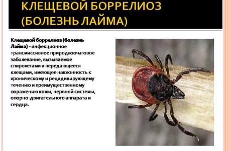 Иксодовый клещевой боррелиоз (ИКБ)