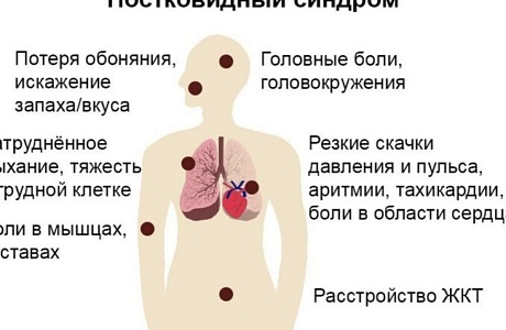 20 вопросов о «постковидном синдроме»
