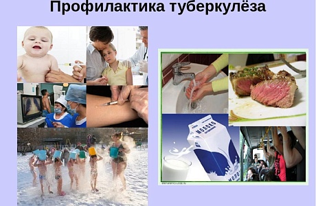 Профилактика туберкулёза. Профилактика туберкулёза.