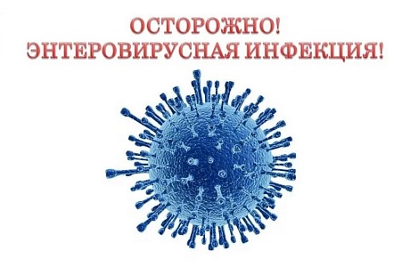 О мерах профилактики энтеровирусной инфекции.