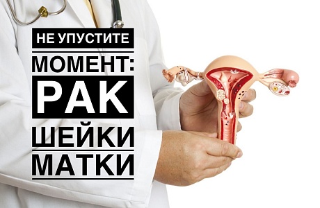 НЕ УПУСТИТЕ МОМЕНТ: РАК ШЕЙКИ МАТКИ НЕ УПУСТИТЕ МОМЕНТ: РАК ШЕЙКИ МАТКИ