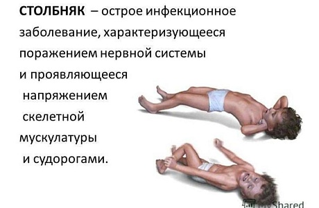 О профилактике столбняка. О профилактике столбняка.