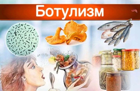 О профилактике ботулизма О профилактике ботулизма